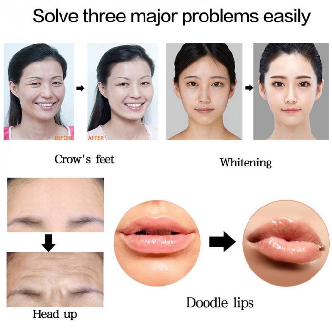 arma ácido hialurónico de alta presión de 0.3ml Hyaluron Pen Lip Filler Injection Atomizer Pen No Needle Mesotherapy para el retiro de la arruga - compra en el precio de $43,20 en aliexpress.com | imall.com