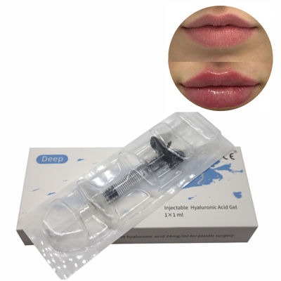 Relleno de ácido hialurónico Relleno de labios sin cirugía