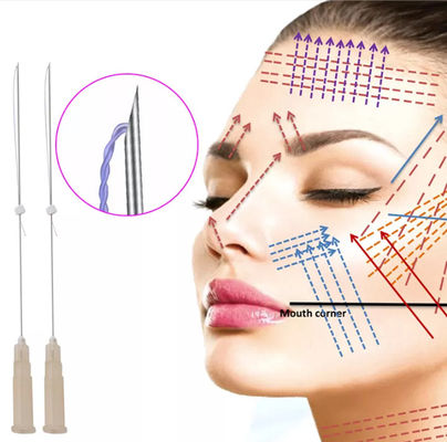 Hilos tensores absorbibles PDO para levantar cuello y mejillas